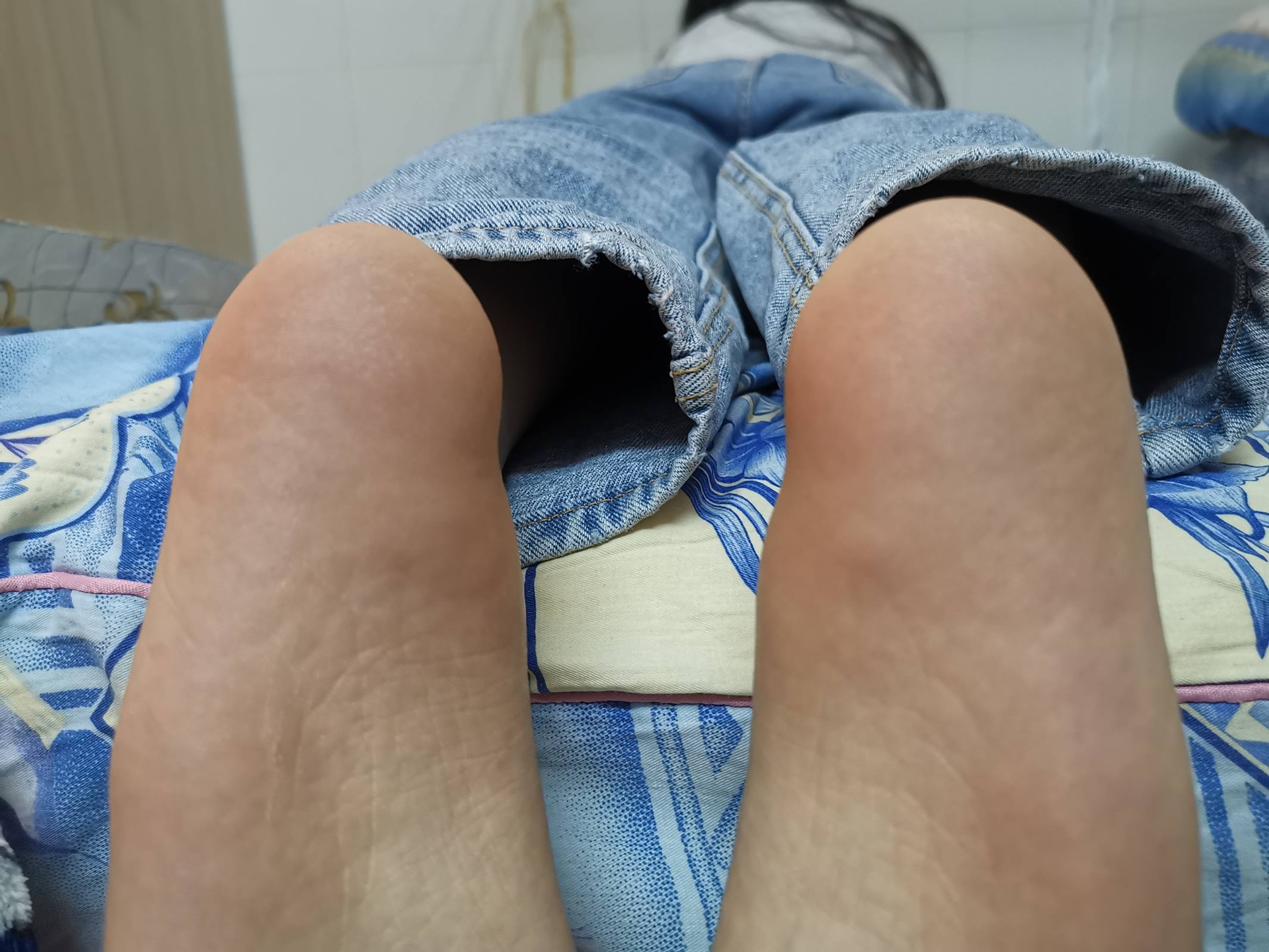 鱼鱼足影@017-第17期：惠思[81P/524MB]