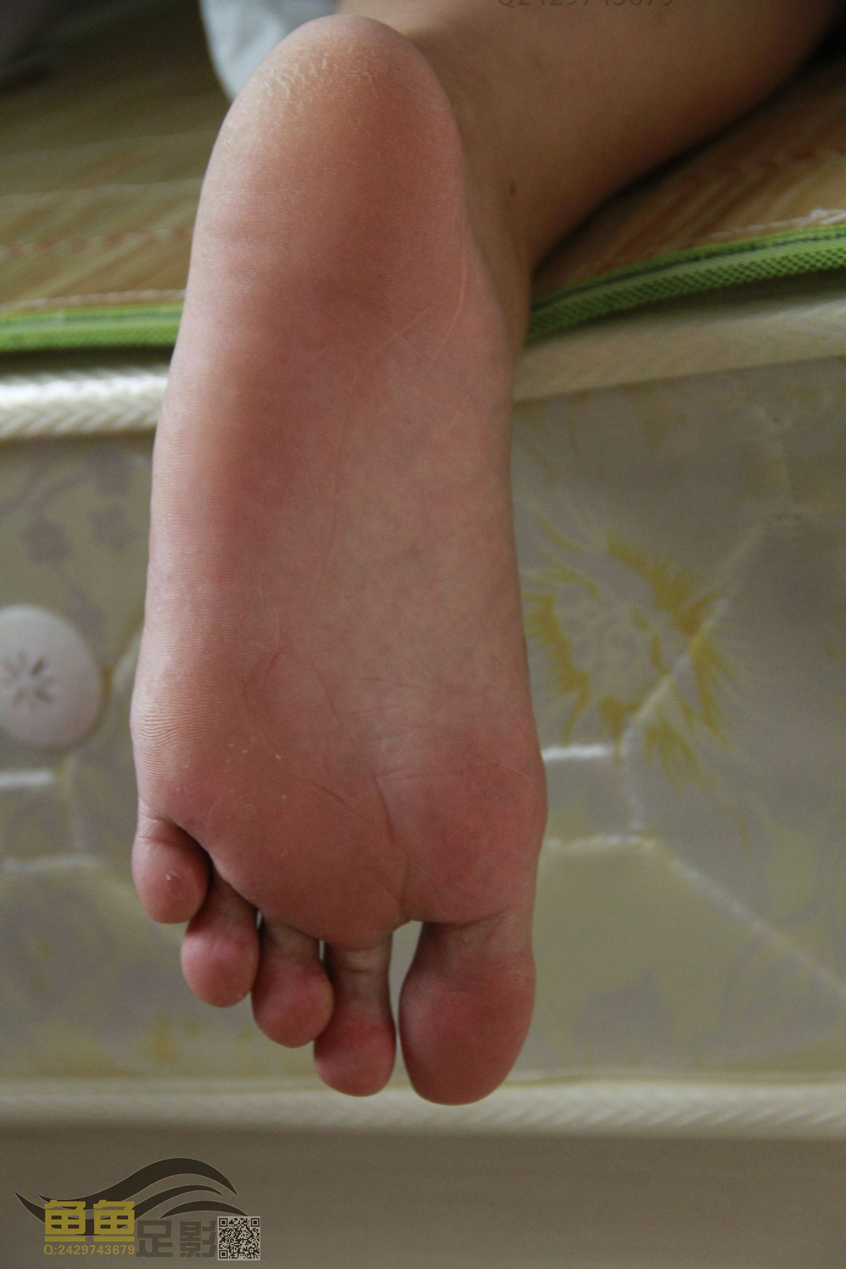 鱼鱼足影@062-第62期：永泰与坝头妹[74P/235MB]